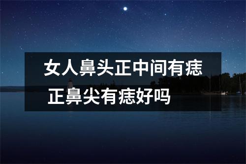 女人鼻头正中间有痣正鼻尖有痣好吗