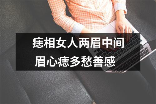 痣相女人两眉中间眉心痣多愁善感