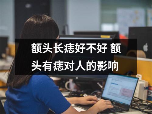 额头长痣好不好额头有痣对人的影响