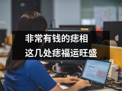 非常有钱的痣相这几处痣福运旺盛