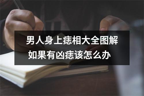 男人身上痣相大全图解如果有凶痣该怎么办