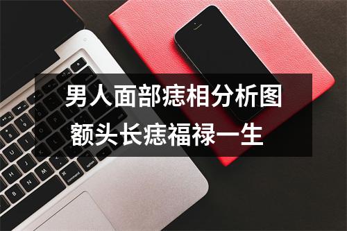 男人面部痣相分析图额头长痣福禄一生