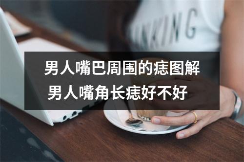 男人嘴巴周围的痣图解男人嘴角长痣好不好