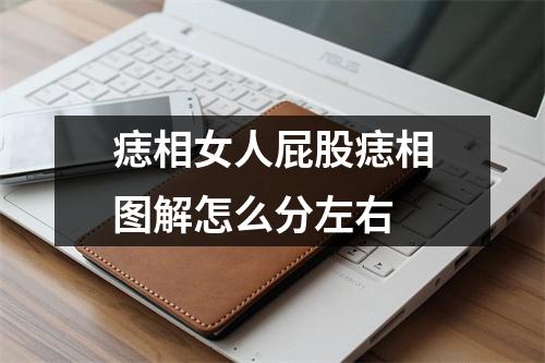 痣相女人屁股痣相图解怎么分左右