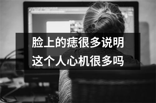 脸上的痣很多说明这个人心机很多吗