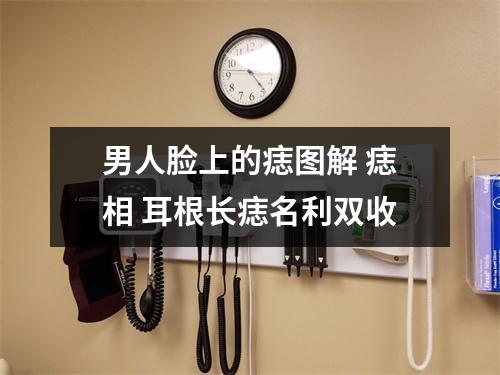 男人脸上的痣图解痣相耳根长痣名利双收