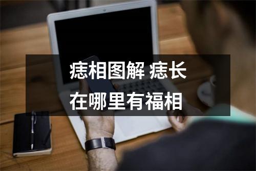 痣相图解痣长在哪里有福相