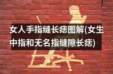 女人手指缝长痣图解(女生中指和无名指缝隙长痣)