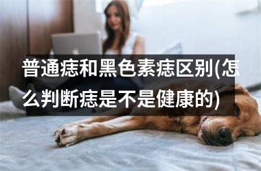普通痣和黑色素痣区别(怎么判断痣是不是健康的)