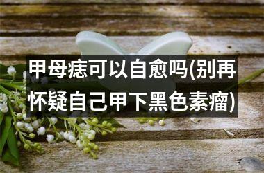 甲母痣可以自愈吗(别再怀疑自己甲下黑色素瘤)