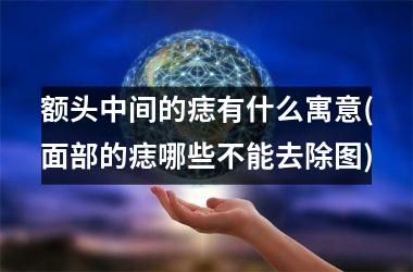 额头中间的痣有什么寓意(面部的痣哪些不能去除图)