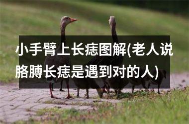 <h3>小手臂上长痣图解(老人说胳膊长痣是遇到对的人)