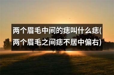 <h3>两个眉毛中间的痣叫什么痣(两个眉毛之间痣不居中偏右)