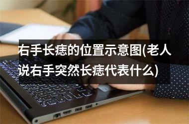 右手长痣的位置示意图(老人说右手突然长痣代表什么)