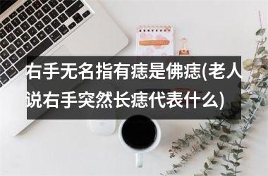 右手无名指有痣是佛痣(老人说右手突然长痣代表什么)