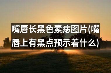 <h3>嘴唇长黑色素痣图片(嘴唇上有黑点预示着什么)