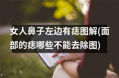 女人鼻子左边有痣图解(面部的痣哪些不能去除图)