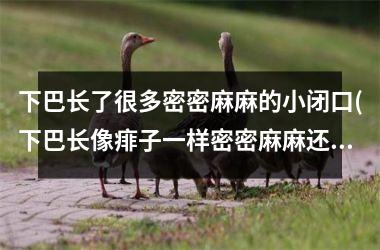 <h3>下巴长了很多密密麻麻的小闭口(下巴长像痱子一样密密麻麻还很痒)