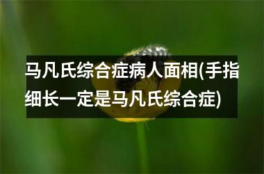 马凡氏综合症病人面相(手指细长一定是马凡氏综合症)